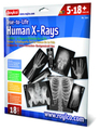 X-Rays - Human, 18 pcs thumbnail