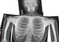X-Rays - Human, 18 pcs thumbnail