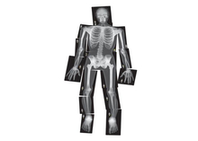 X-Rays - Human, 18 pcs