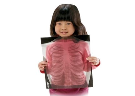 X-Rays - Human, 18 pcs